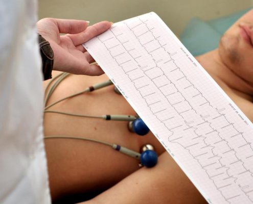 electrocardiogram-2-495x400